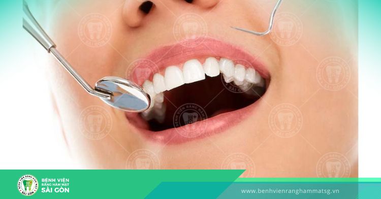 Bọc răng sứ an toàn tại nha khoa