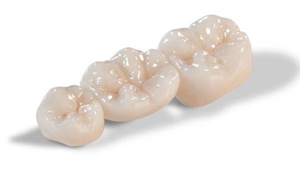 Tổng hợp những điều cần biết về răng sứ Zirconia