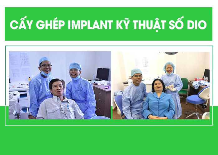 Implant nha khoa là gì?