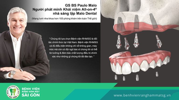 GS Paulo Malo là người sáng lập ra phương pháp Implant All on 4