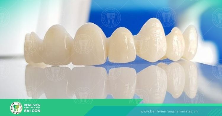 Răng sứ - Tổng quan những vấn đề quan trọng